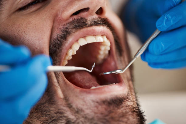 Best Broken or Cracked Tooth Emergency Dentist in Westbrook Center, CT